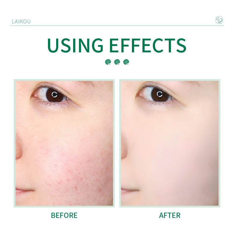 Centella Asiatica Facial Cleanser 50g for Pores