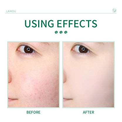 Centella Asiatica Facial Cleanser 50g for Pores