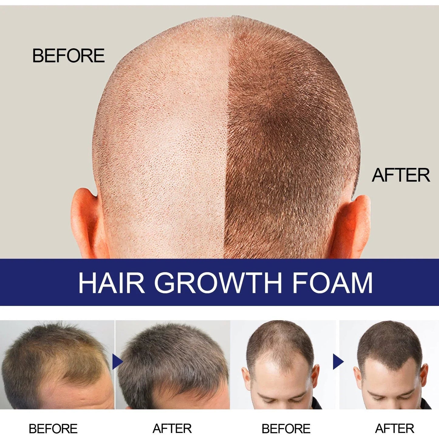 N Men's Dense Hair Foam Deep Repair Care
