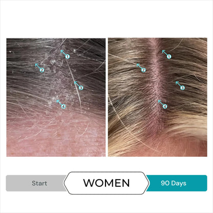 Dandrene Anti-Dandruff Conditioner